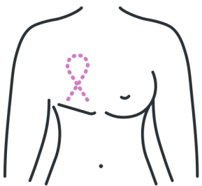 R&eacute;&eacute;ducation Infantile